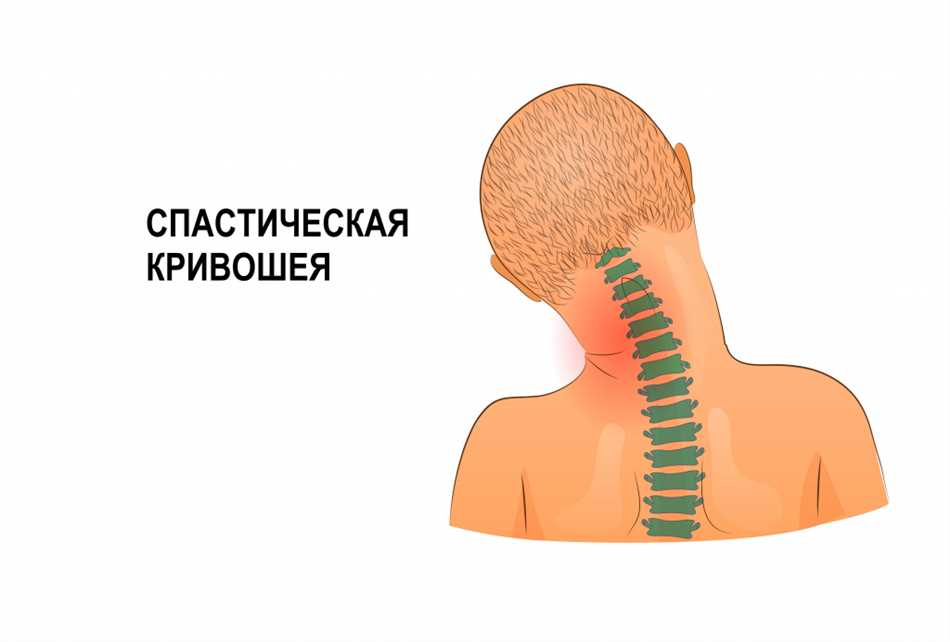 Что делать, если у утки кривая шея?