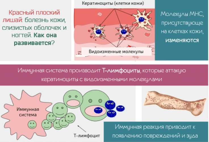 3. Профессиональная помощь