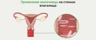 Какие заболевания вызывают патогенные грибы: список и симптомы