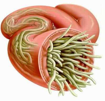Возможен ли рост глистов в человеке?
