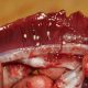 Опасность червей в мясе для человека: нужно ли беспокоиться?