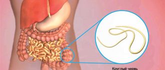 Почему человек заражается аскаридами чаще чем плоскими паразитическими червями — причины и факторы