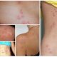 Как найти клопа постельного: лучшие способы обнаружения