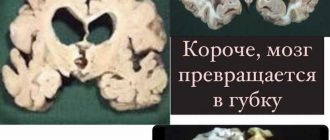 Каннибализм и его последствия: какая болезнь возникает у каннибалов?