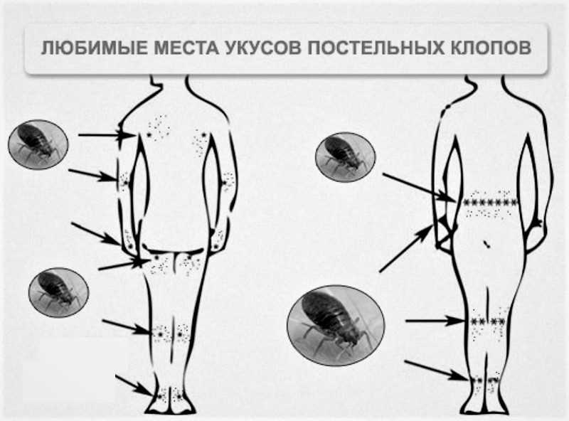 Могут ли укусы клопов проявиться через сутки?