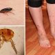 Срок жизни блох без человека: интересные факты и исследования